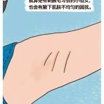 腋毛漫画