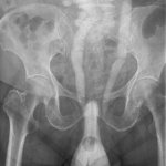 xray hentai of penis inside vagina