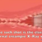 xray hentai of penis inside vagina