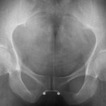 xray hentai of penis inside vagina