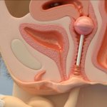 xray hentai of penis inside vagina