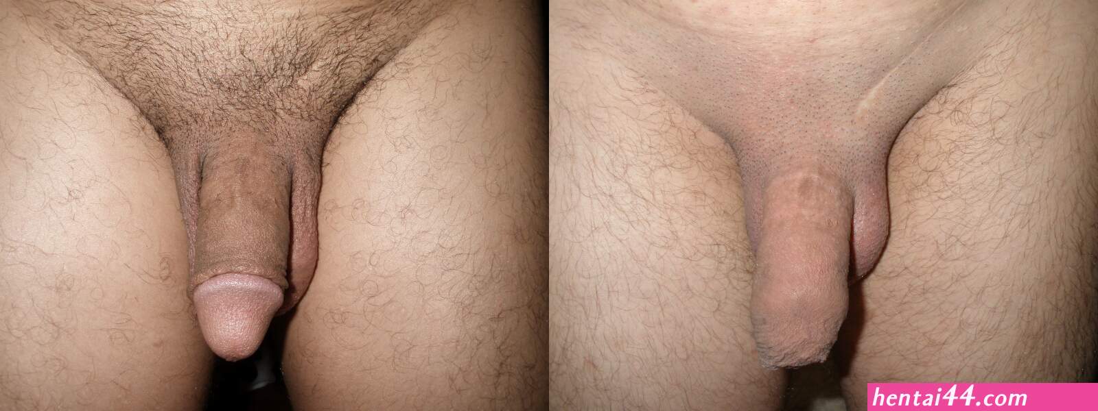 Longest penis being circumcised animation hentai pics